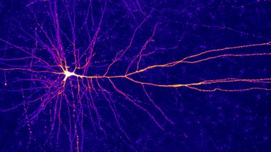 Фото - Мозги в чашке: нейробиологи научили нейроны мозга играть в видеоигру
